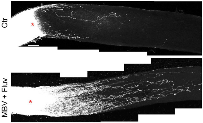 マウスの視神経を圧迫して傷つけ（赤星の部分）2週間後の視神経。生理食塩水（Ctr）の注入だけでは軸索は再生しないが（上）、スタチン（Fluv）とナノ構造体（MBV）を注入すると（下）、1.2ミリ程度まで伸びた（ピッツバーグ大学の桑島孝明助教提供）