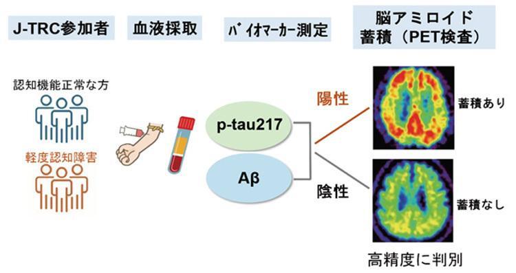 血液検査により原因物質（p-tau217＝タウ、Aβ＝アミロイドベータ）の蓄積を判別する研究の概念図（岩坪威教授らの研究グループの新潟大学・池内健教授作成、同グループ提供）