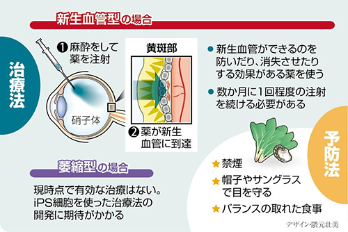 治療法と予防